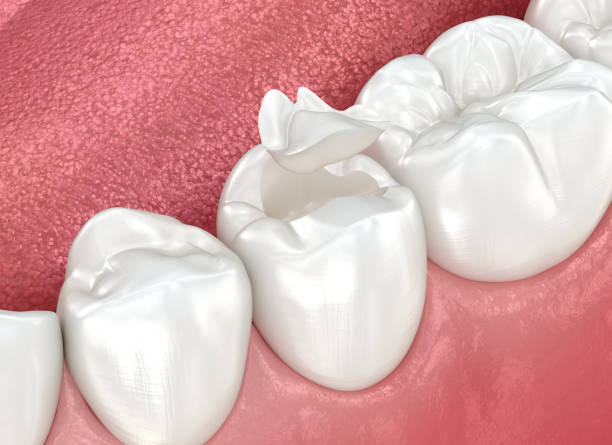 Best Emergency Dental Care  in Coloma, MI