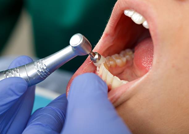 Best Tooth Extraction  in Coloma, MI